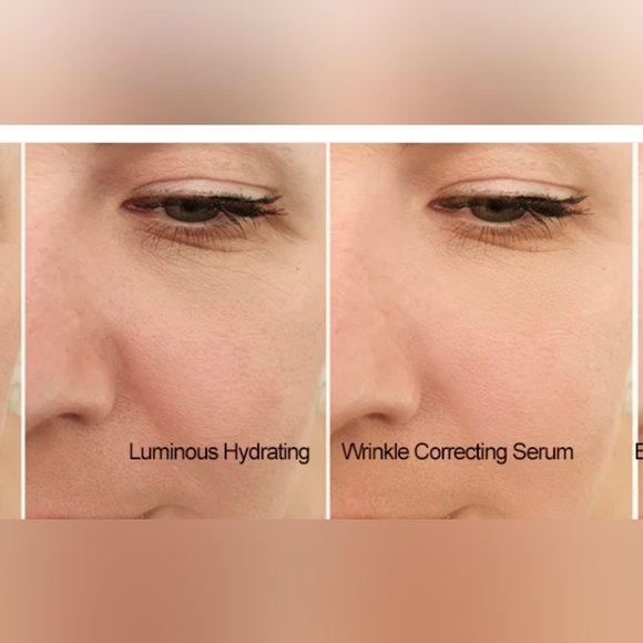 Luminous Las Vegas Non Surgical Face Lift - Picture 4 of 4